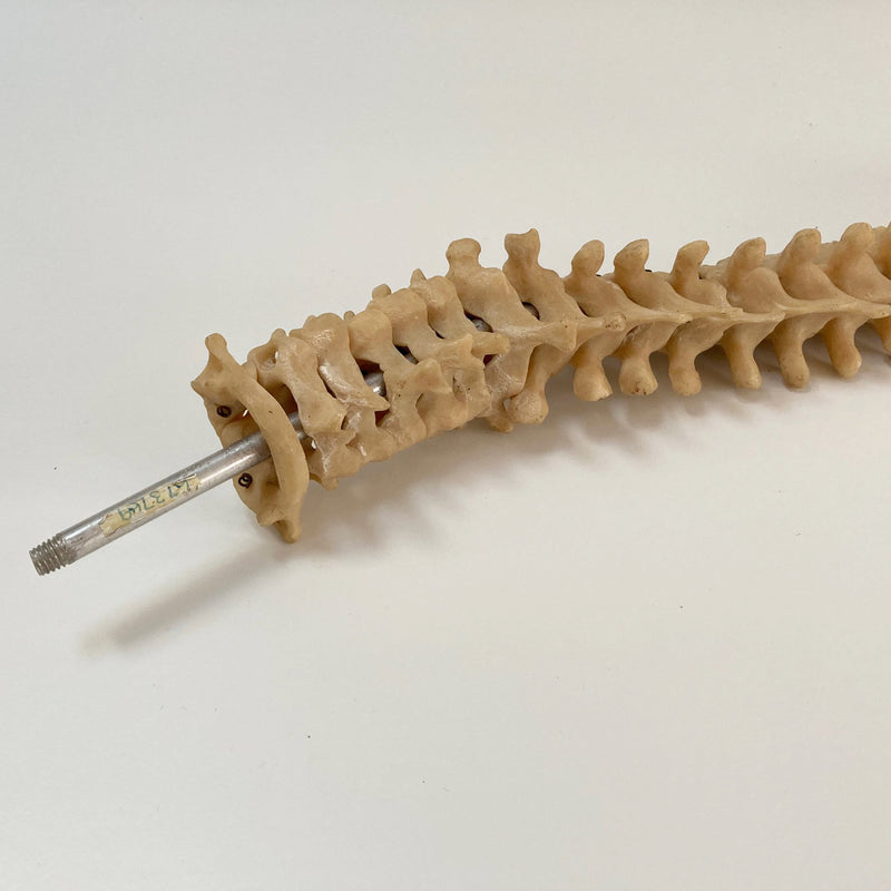 Scoliosis Spinal Column Model by Educational & Scientific Plastics Ltd