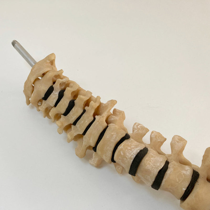 Scoliosis Spinal Column Model by Educational & Scientific Plastics Ltd
